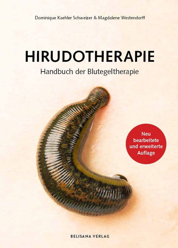 Hirudotherapie