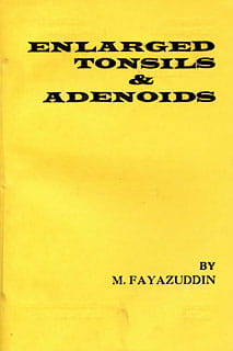 Enlarged Tonsils & Adenoids