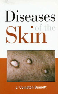 Diseases of the Skin